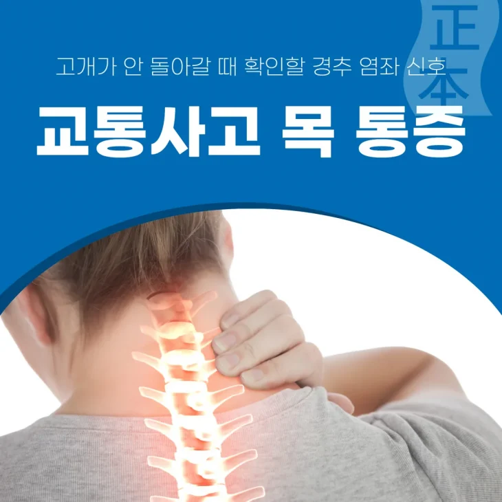 교통사고 목 통증, 고개가 안 돌아갈 때 확인할 경추 염좌 신호