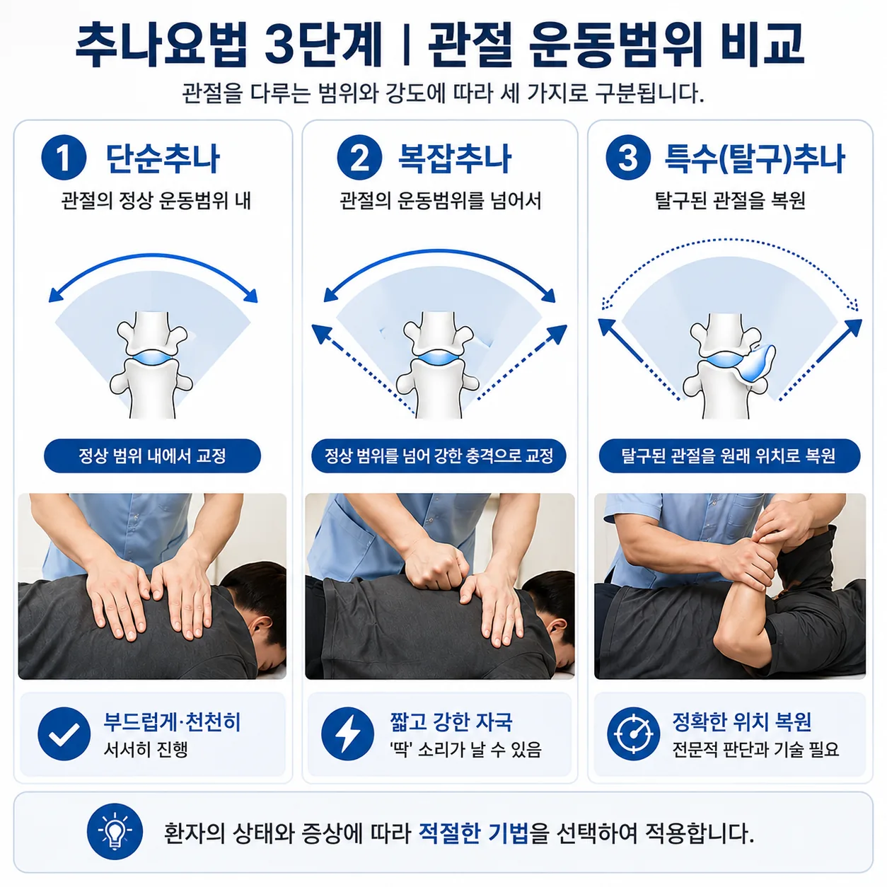 단순추나 복잡추나 특수 탈구추나의 관절 운동범위 차이를 나타낸 도해