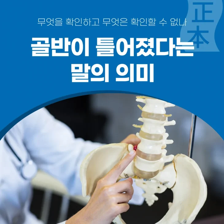 골반이 틀어졌다는 말의 의미 — 무엇을 확인하고 무엇은 확인할 수 없나