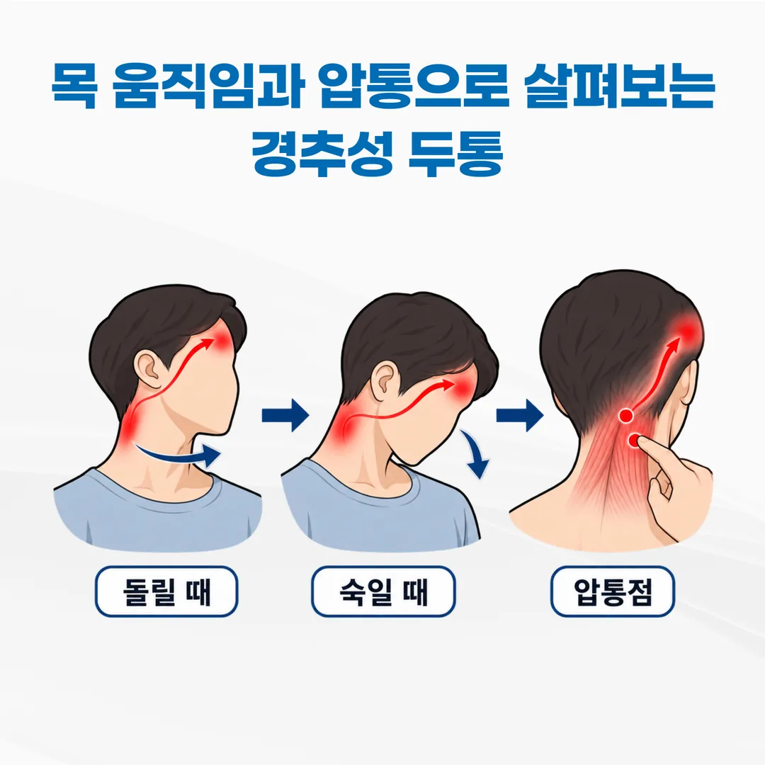 목 동작과 뒷목 압통 확인으로 두통 재현 여부를 살피는 순서 도식