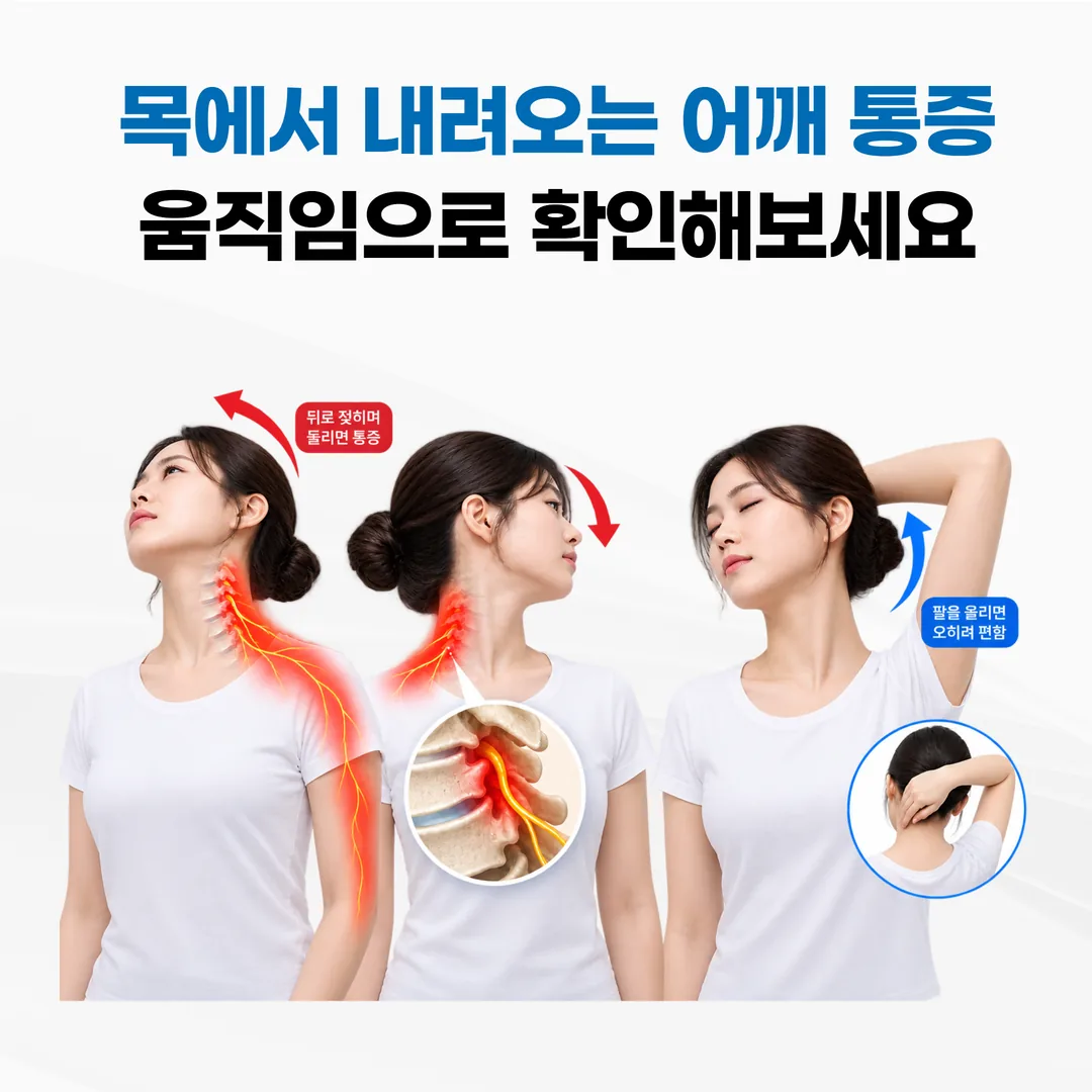 목에서 내려온 어깨 결림을 확인하는 고개 회전 동작과 팔 올리기 동작 비교 그림